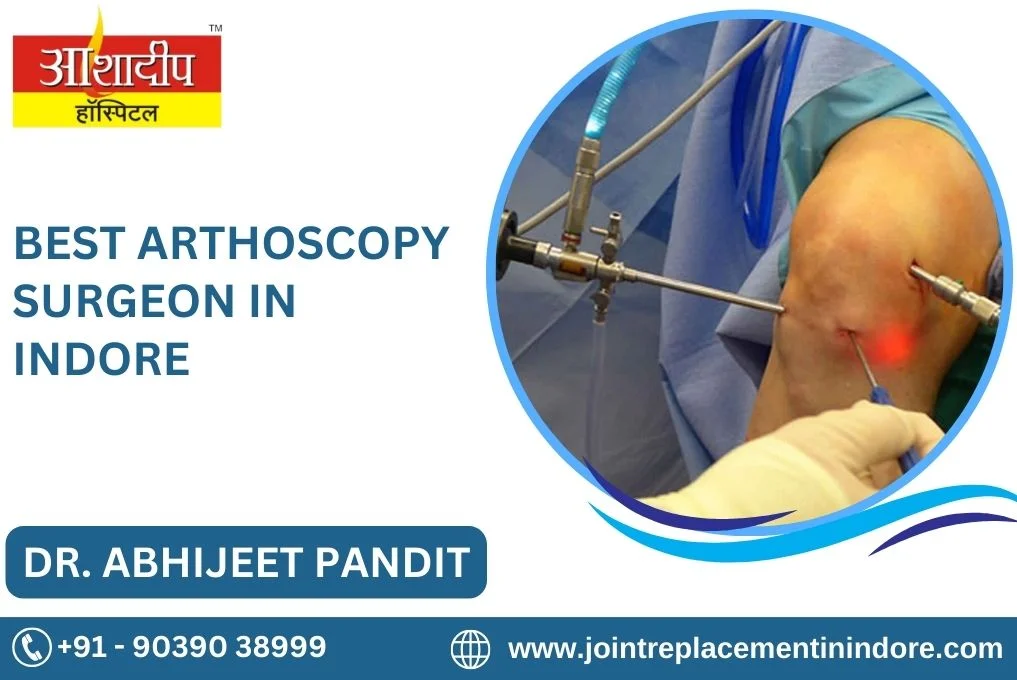 Best Arthroscopy Treatment In Indore