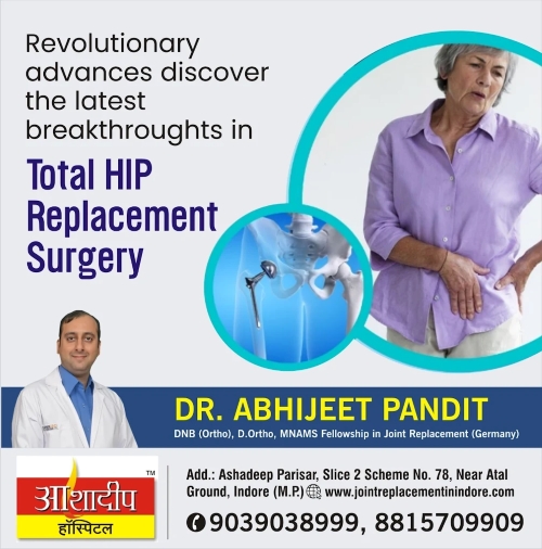 What is Total Hip Replacement Surgery and its Types