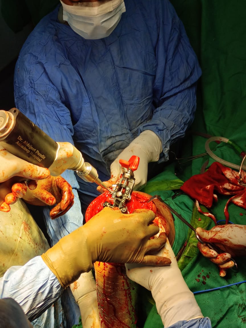 Best Orthopedic Doctor in Indore 
